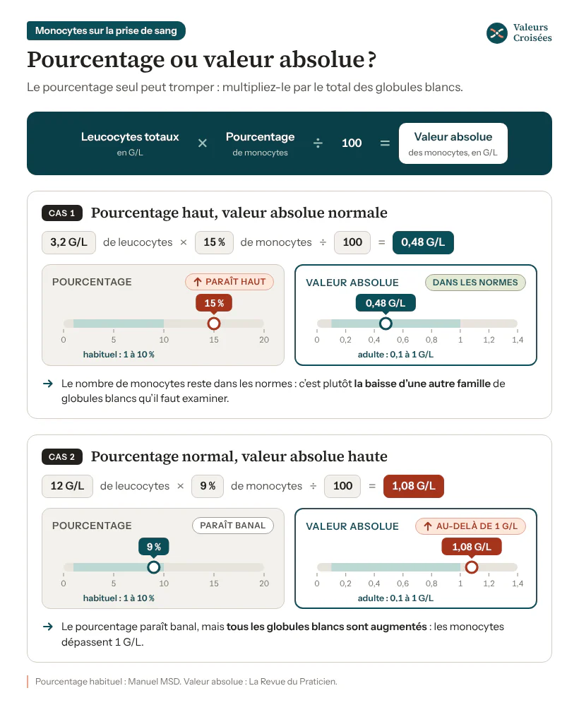 Monocytes : valeur absolue ou pourcentage, deux exemples chiffrés Calcul de la valeur absolue des monocytes (leucocytes × pourcentage ÷ 100) sur deux exemples : 3,2 G/L × 15 % = 0,48 G/L, pourcentage haut mais nombre normal ; 12 G/L × 9 % = 1,08 G/L, pourcentage banal mais nombre au-delà de 1 G/L.